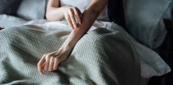 팔 긁는사진
