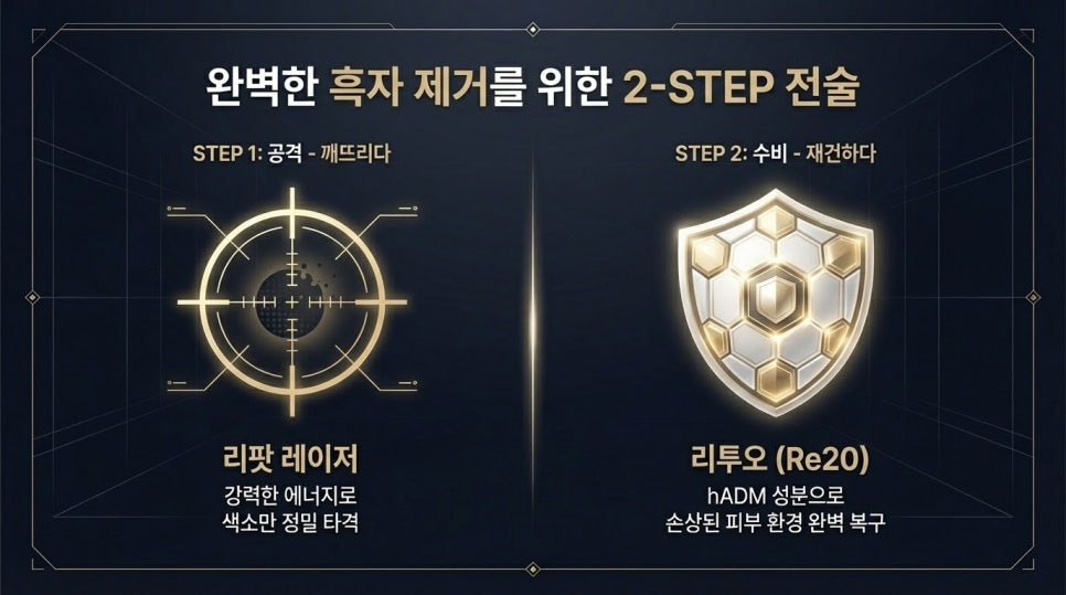 얼굴 흑자 제거 리팟 레이저
