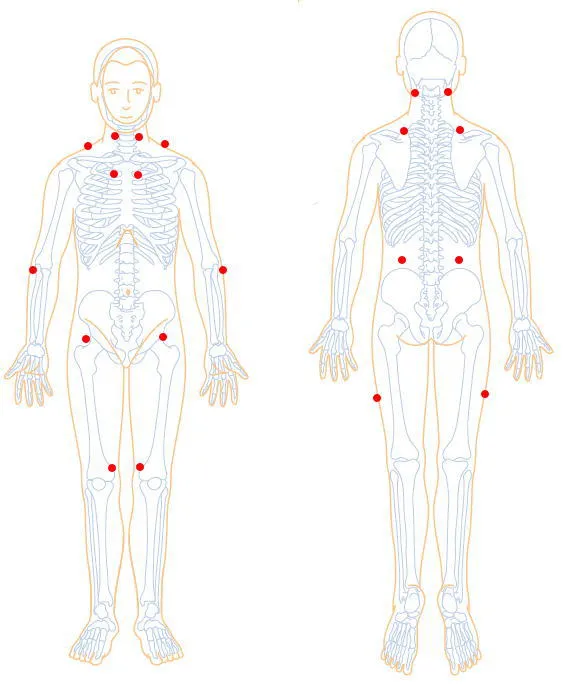 섬유근육통-만성-통증-원인부터-증상-치료-그리고-통증-완화에-좋은-음식-추천!