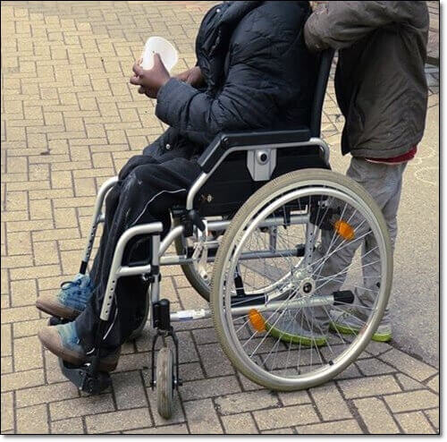 고관절 활액막염 환자