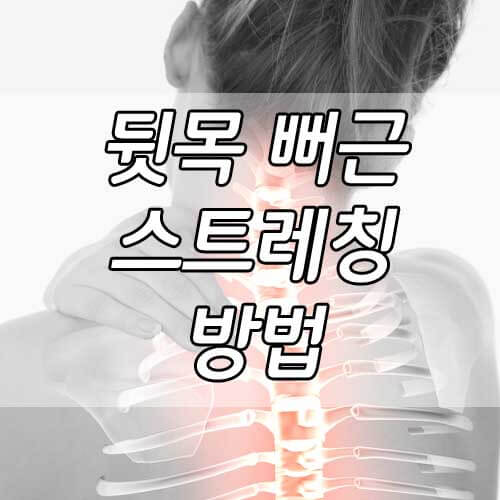 뒷목 뻐근&#44; 목 어깨 뻐근할때&#44; 뒷골 땡길때&#44; 뒷목 뻐근할때 시원해지는 방법