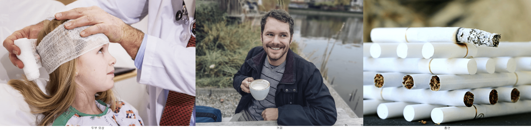 두부외상, 커핏소비, 흡연