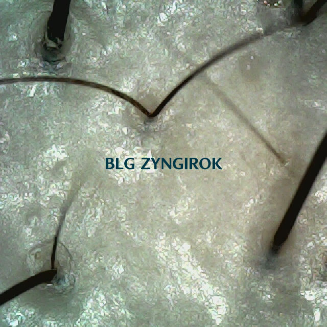 탈모 극복 프로젝트 - 정수리와 이마 사이 두피모습이다.