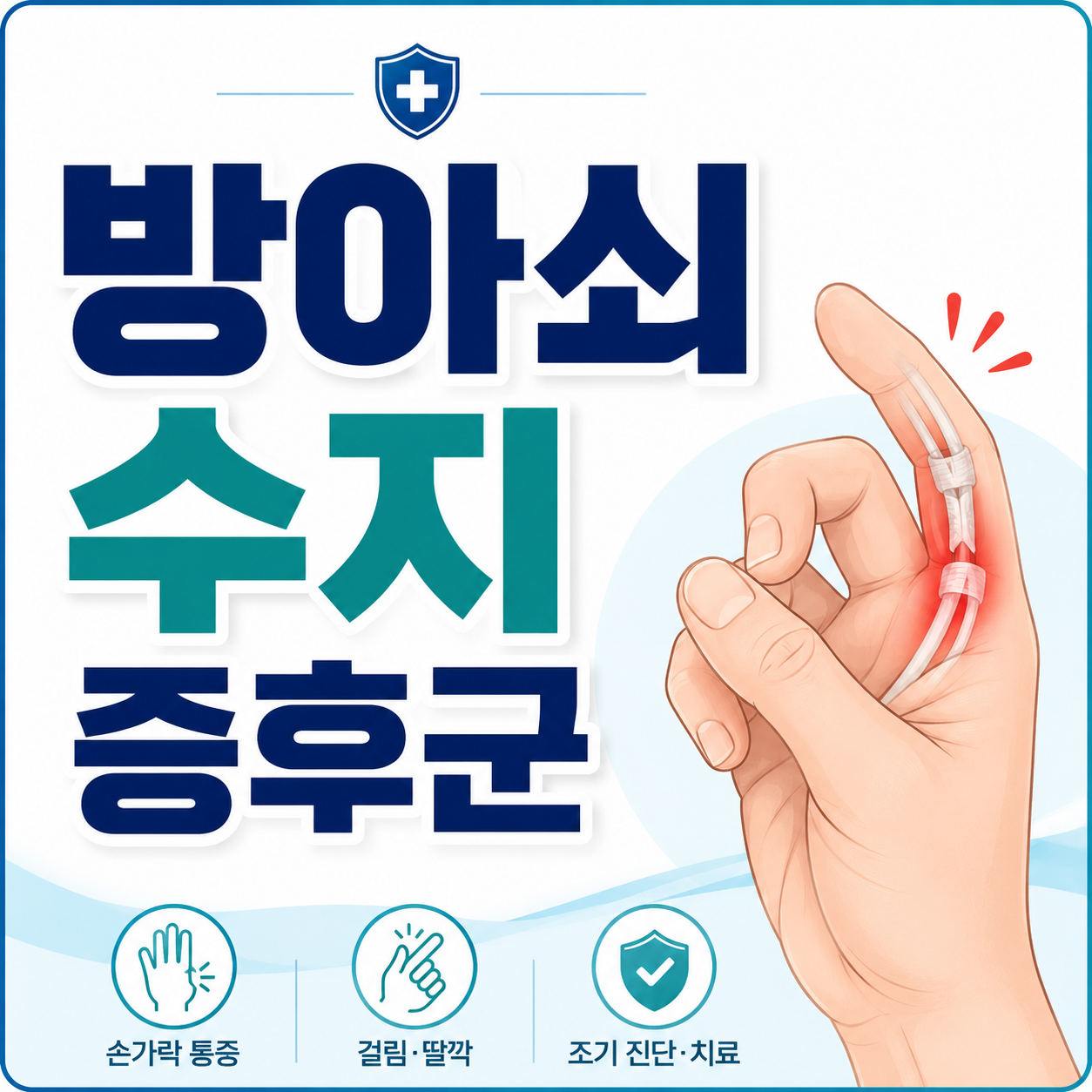 방아쇠 수지 증후군