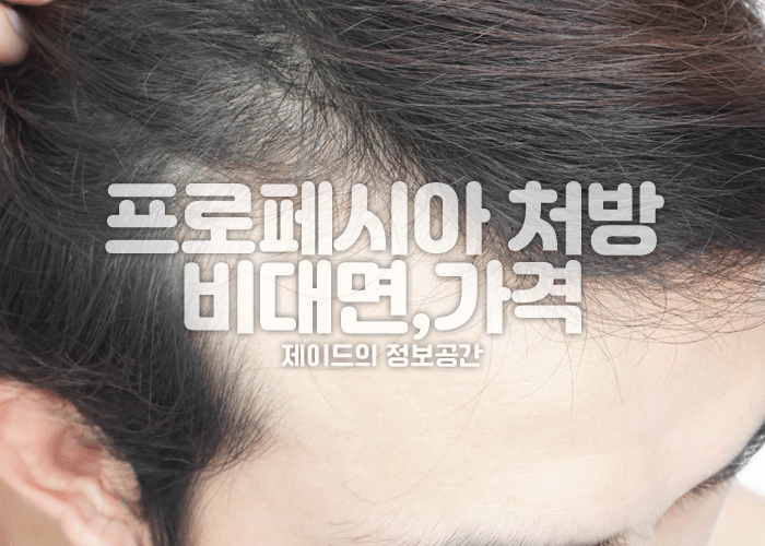 프로페시아 부작용, 비대면 처방, 가격, 카피약