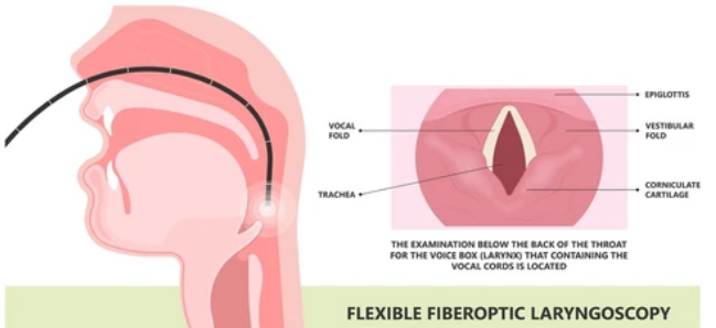 후두암 검사방법