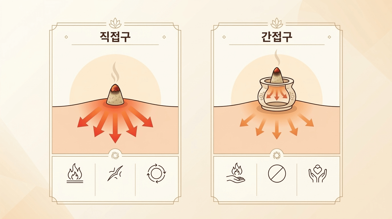 쑥뜸 직접구 간접구 비교 인포그래픽