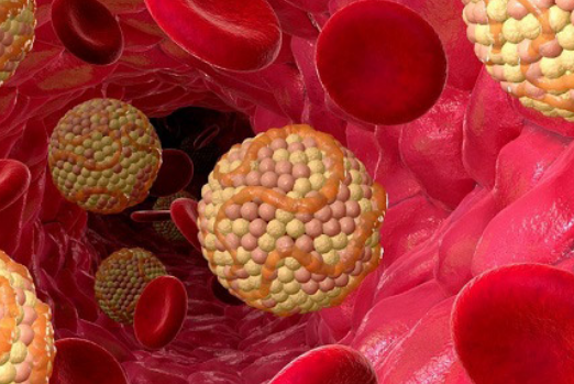 고지혈증 약 장기 복용 시 부작용