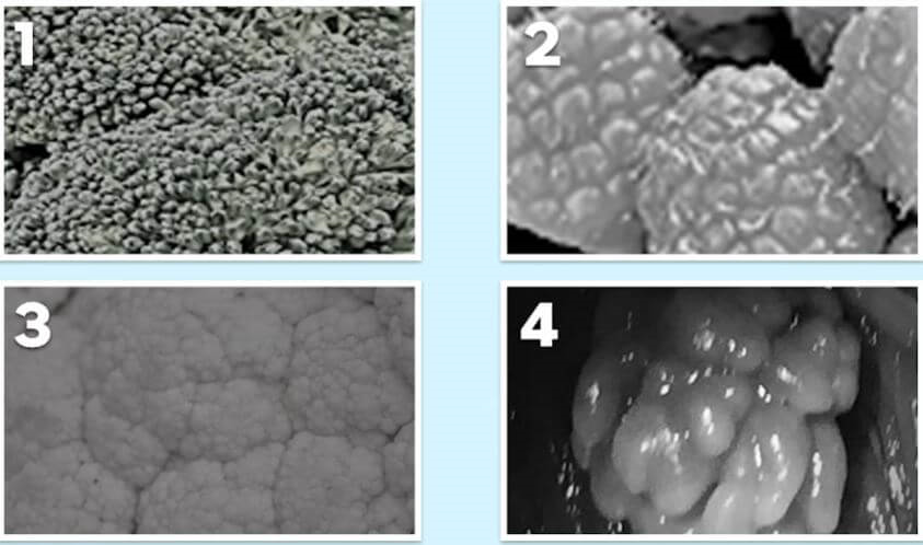 곤지름 모양 구별 사진