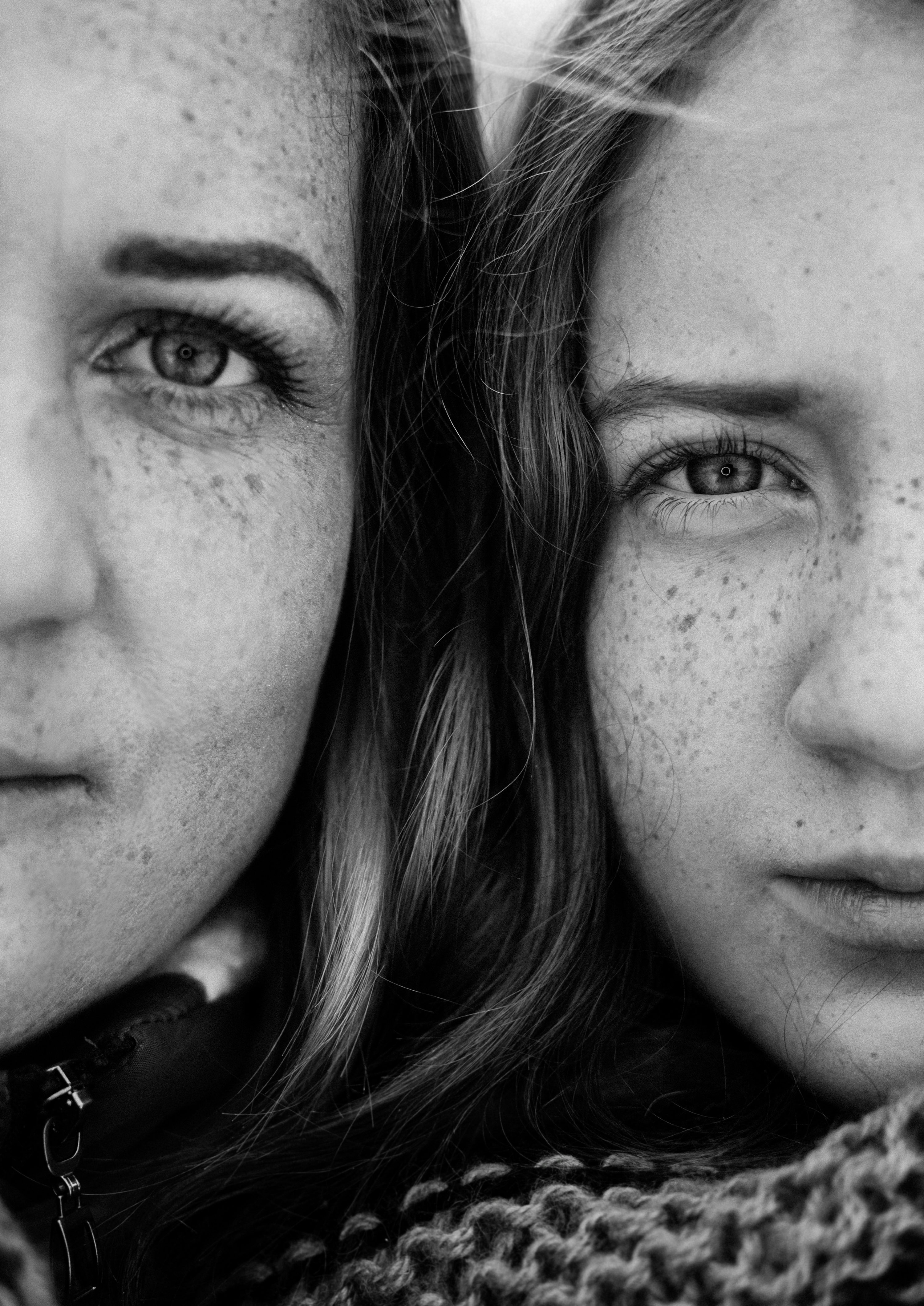 기미 잡티 완벽 제거법