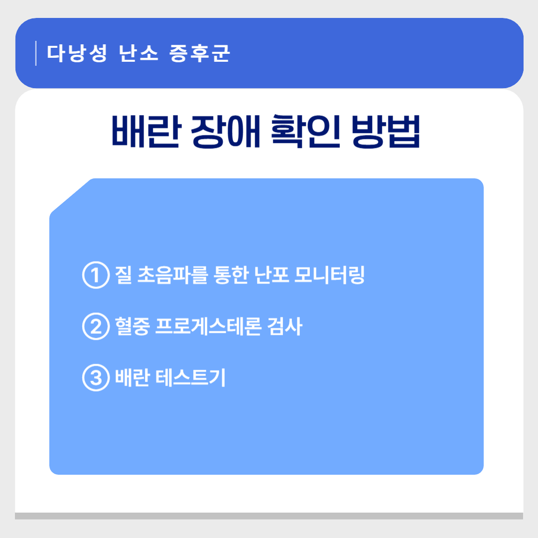 다낭성 난소 증후군