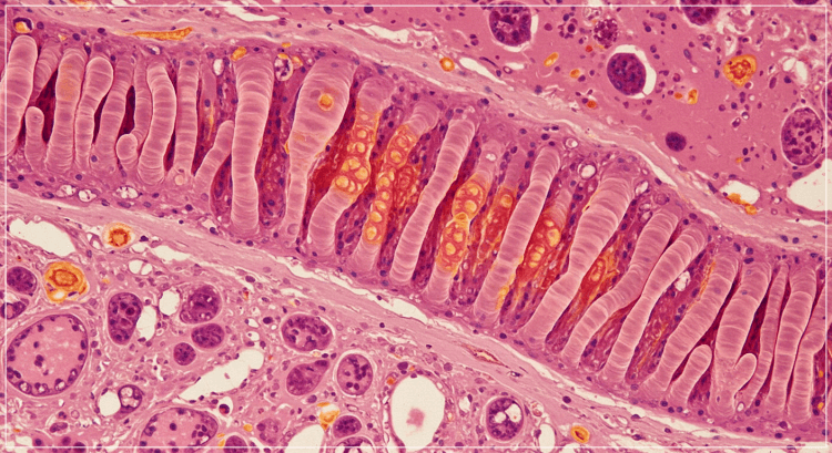 장염 증상 생물학 사진
