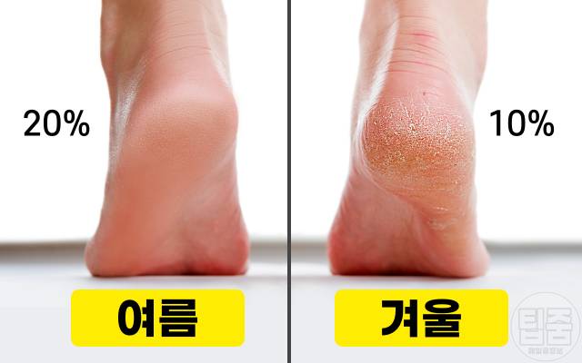 발각질 제거