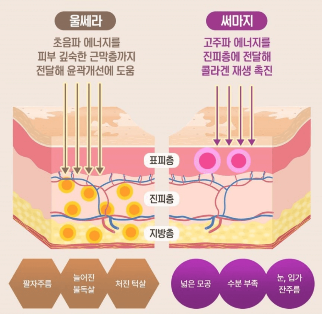 울세라 써머지