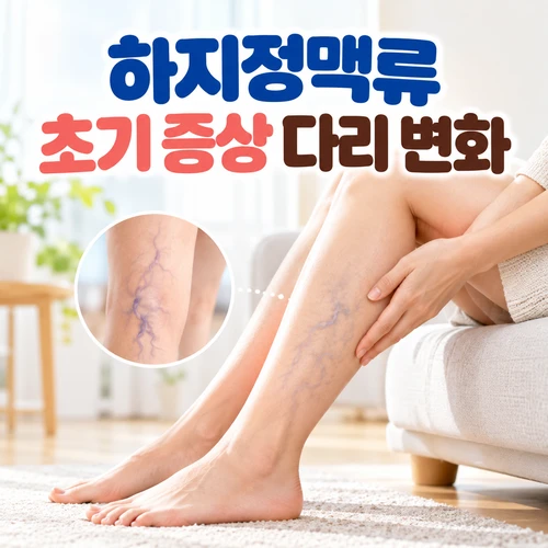 하지정맥류 초기 증상 다리 변화