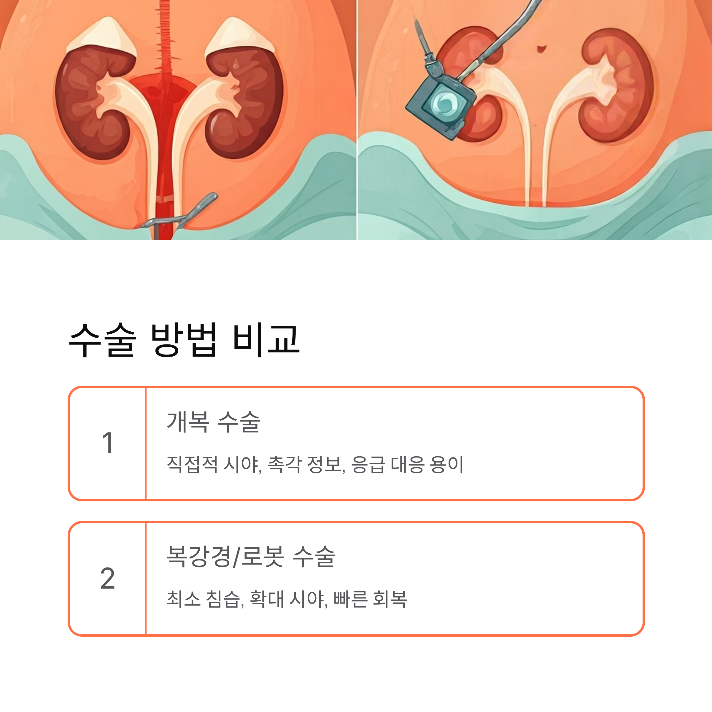 신장암 수술 방법 비교