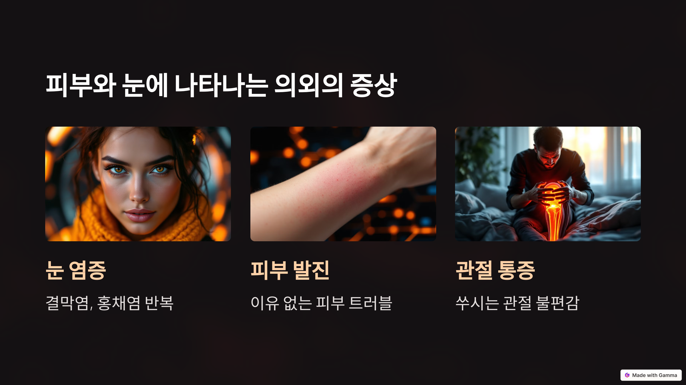 궤양성대장염 피부와 눈에 나타나는 의외의 증상