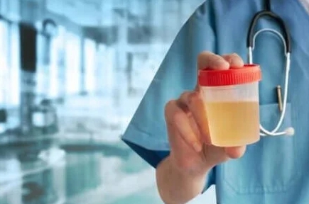 소변 색깔이 노란색