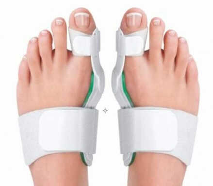 무지외반증 교정기 착용 모습