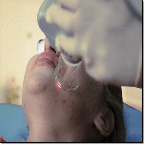 피부 미용에 좋은 적양파즙 효능