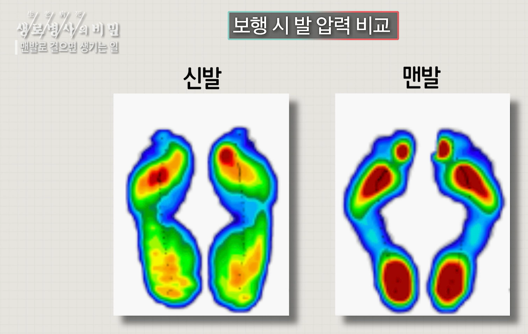 맨발 걷기 효능
