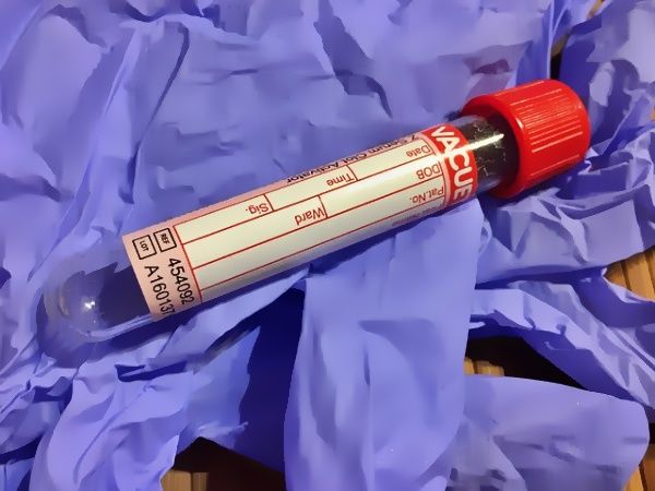 Neutrophil 수치