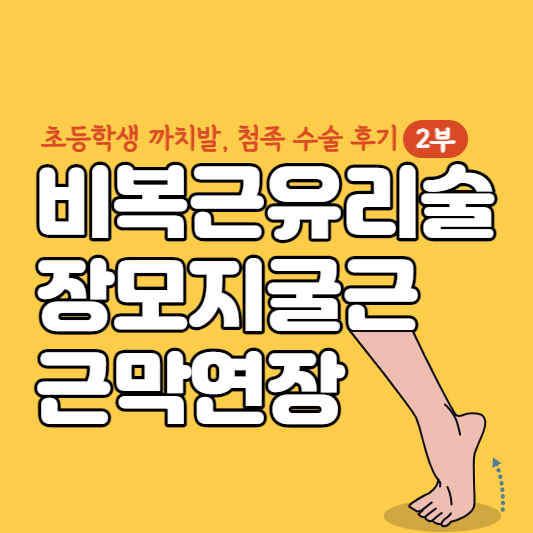 비복근유리술-장모지굴근-근막연장-썸네일