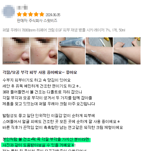 퍼델 우레아크림 리뷰와 후기 사진