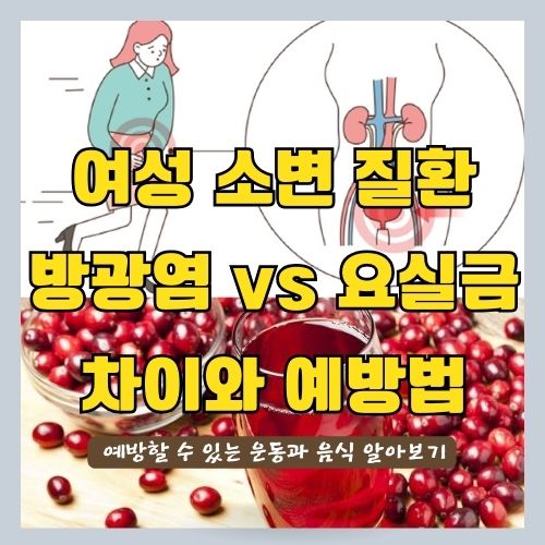 소변이자주마려워요 - 방광염과 요실금의 원인과 예방 썸네일