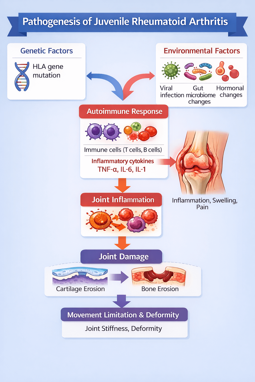 소아 류마티스 관절염