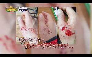 개에게 물려 손위로 새빨간 피가 흥건하다.