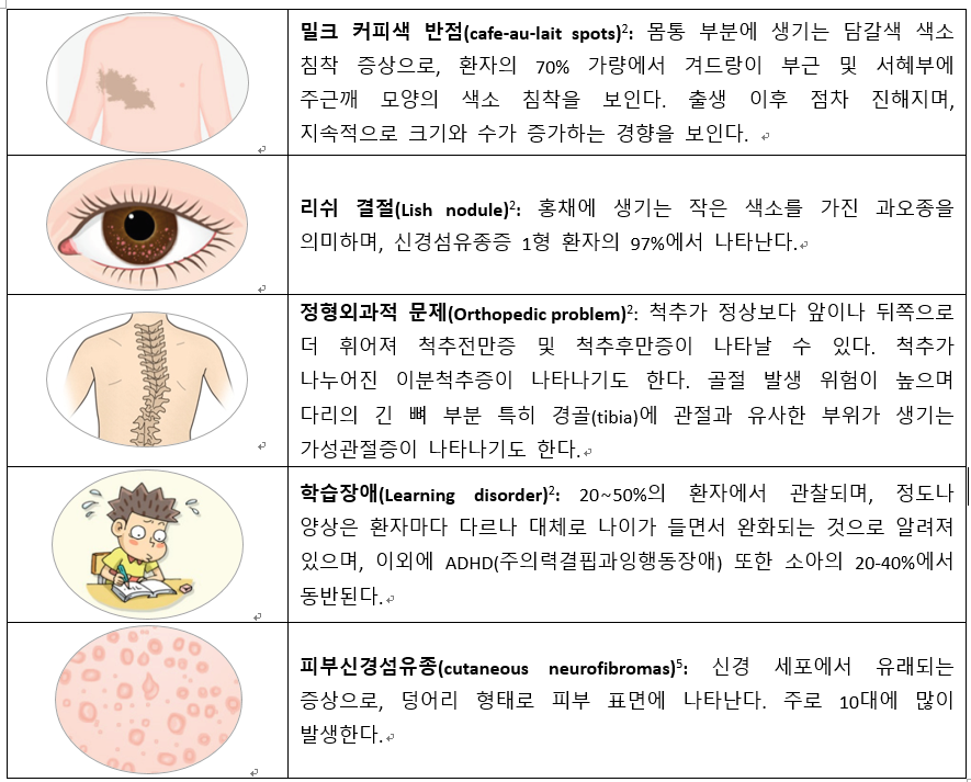 신경섬유종 증상