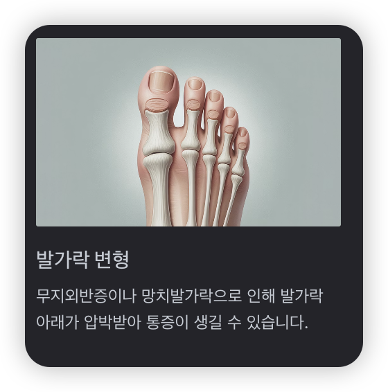 발가락-아래-통증-발가락-변형