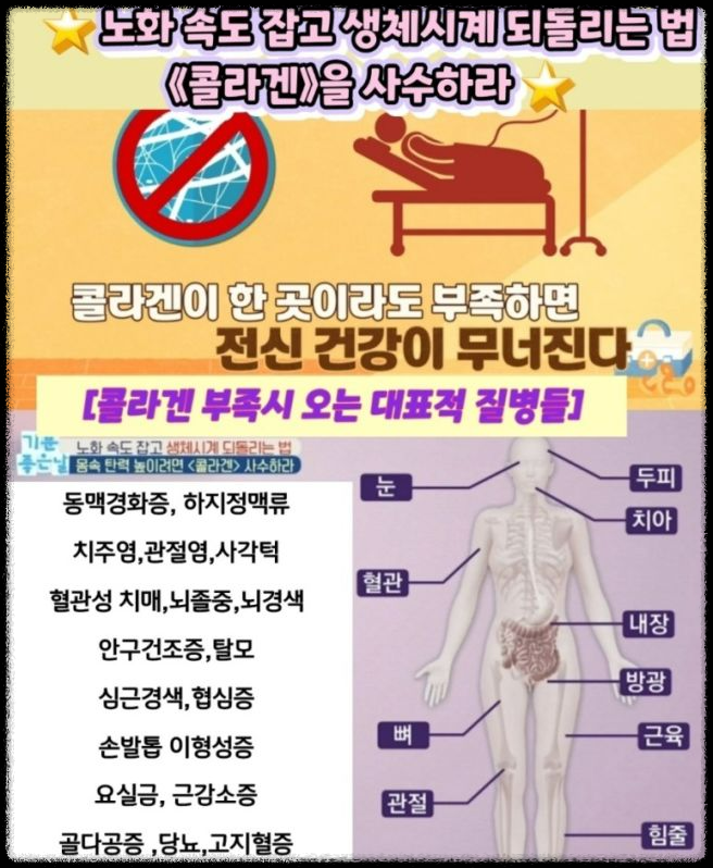 콜라겐과 치매: 두 가지의 숨겨진 연관성