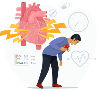 심근경색-초기증상