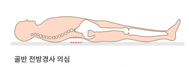 전방경사누운자세