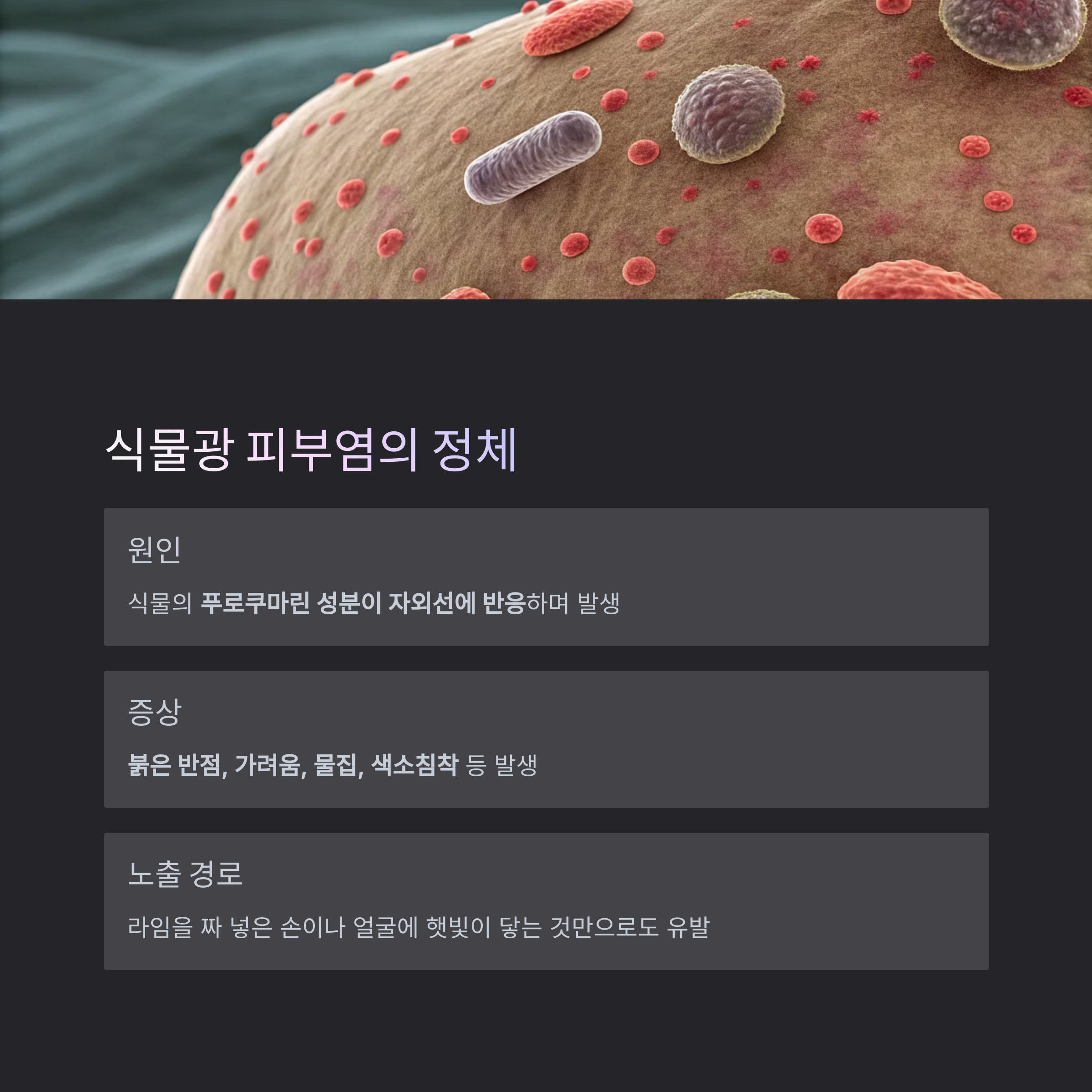 식물광 피부염의 정체