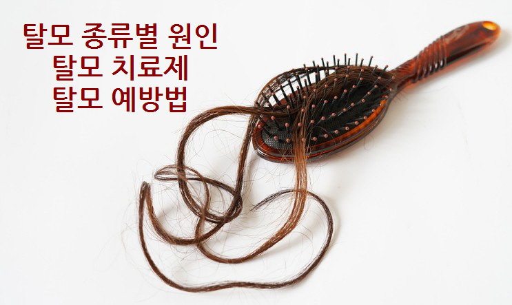 탈모 종류별 원인, 치료제, 예방법