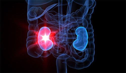 신장 건강에 좋은 음식 10가지