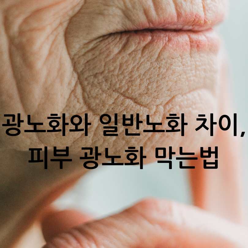 광노화와 일반 노화 차이, 피부 광노화 막는법