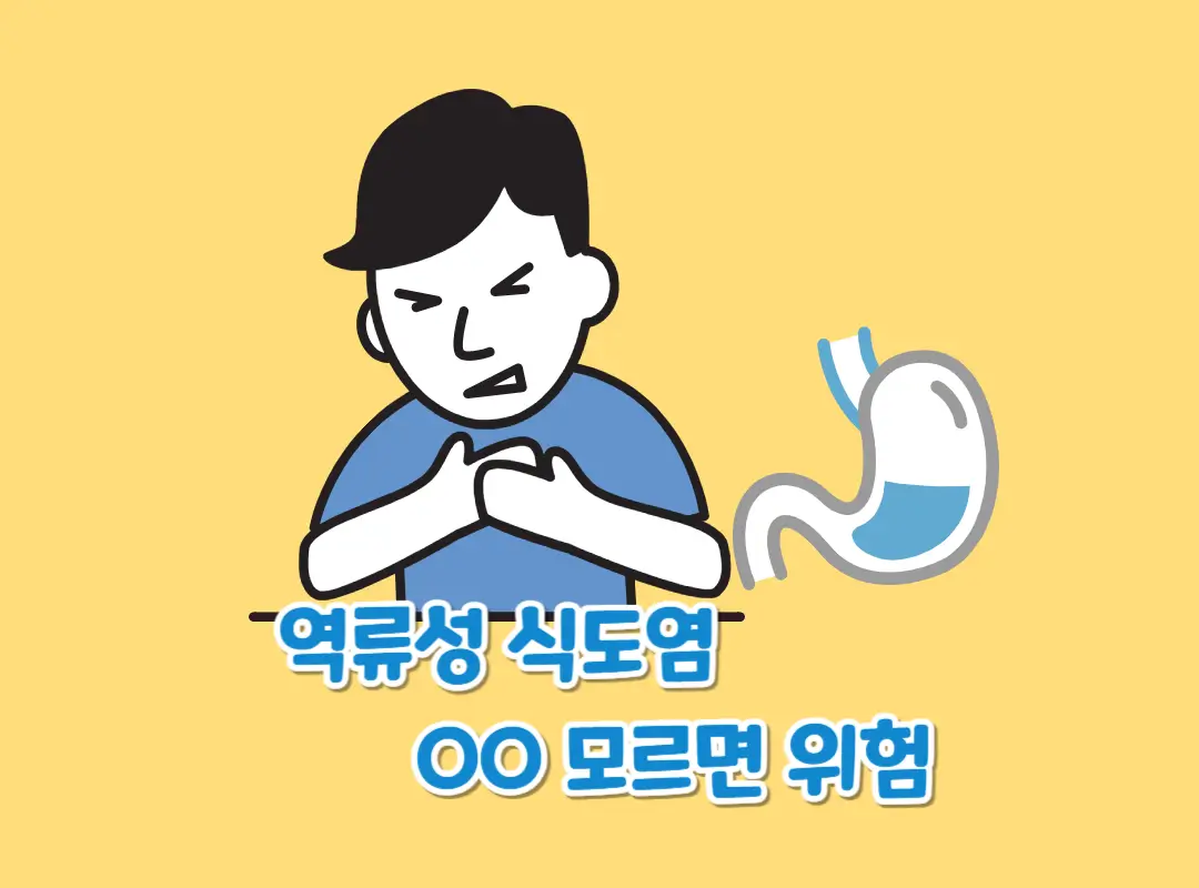 역류성 식도염 섬네일