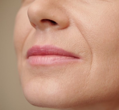 팔자주름 시술 효과/장점/단점/추천대상 - 콜라겐 주사(미희주사), 쥬베룩 볼륨, 스컬트라, 울쎄라, 써마지