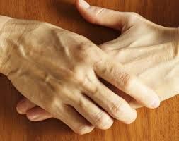 손등에 힘줄이 튀어나오는 이유