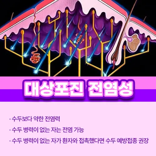 대상포진 전염성