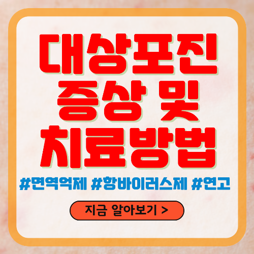 대상포진 초기 증상 및 치료방법