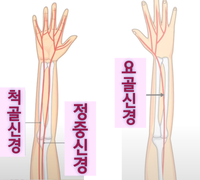 손저림을 유발하는 신경