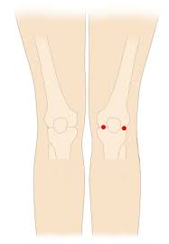 오금이 아픈 이유