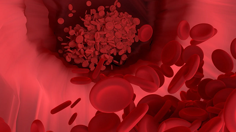 에이펙셀 혈행개선케어