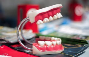 잇몸이 내려가는 치은축퇴