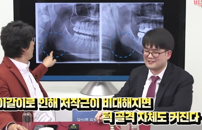 턱관절-명의-고홍섭-교수